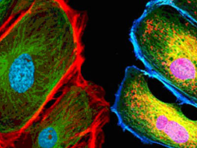 無自發(fā)熒光，成像效果佳，可用于熒光顯微實(shí)驗(yàn)、激光共聚焦顯微實(shí)驗(yàn)、熒光原位雜交（FISH）和相差顯微實(shí)驗(yàn)等